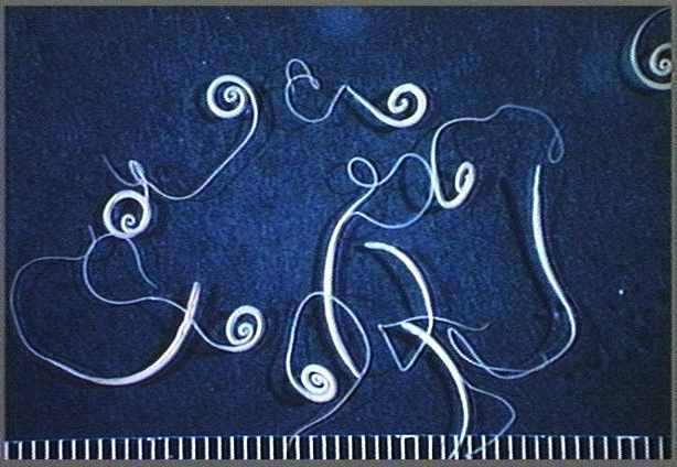 Image from www.Nematode.net. Credit: http://www.latech.edu/ans/faculty-staff/liberatos-james-d/parasite-pictures.shtml