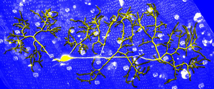 Artist's rendition of dendrite regeneration (yellow) in a fruit fly during metamorphosis.  (Chay Kuo Lab, Duke University)